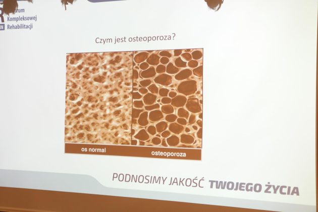 prezentacja dotyczaca osteoporozy