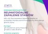 Program wczesnego wykrywania reumatoidalnego zapalenia stawów (RZS) w Piasecznie